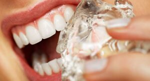 Dental damage habits , عادات تضر الأسنان 